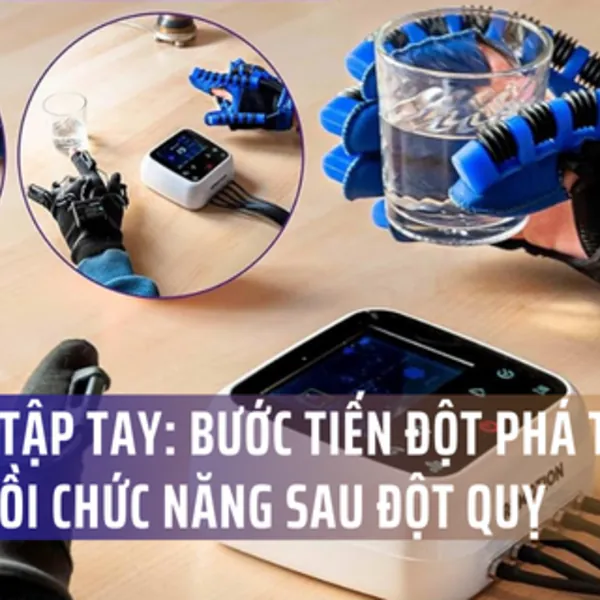 Robot tập tay: Bước tiến đột phá trong phục hồi chức năng sau đột quỵ
