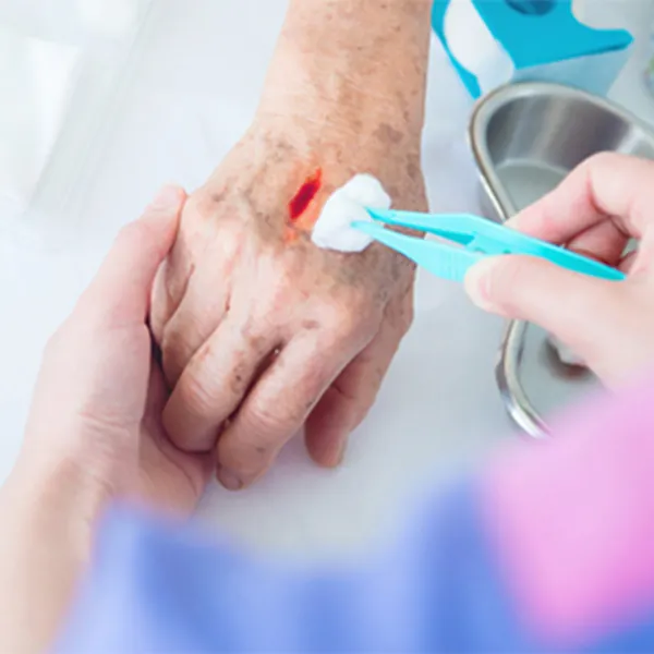 Thời gian lành vết thương và cách chăm sóc đúng để tránh biến chứng nguy hiểm