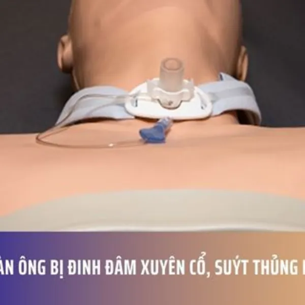 Người Đàn Ông Bị Đinh Đâm Xuyên Cổ, Suýt Thủng Khí Quản