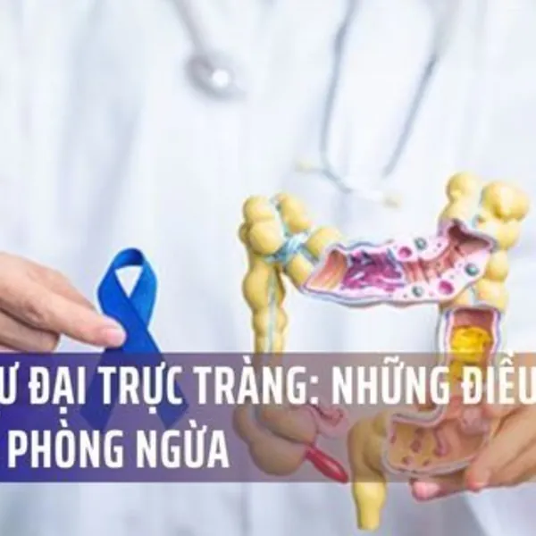 Ung Thư Đại Trực Tràng: Xu Hướng Gia Tăng Và Những Điều Cần Biết Để Phòng Ngừa