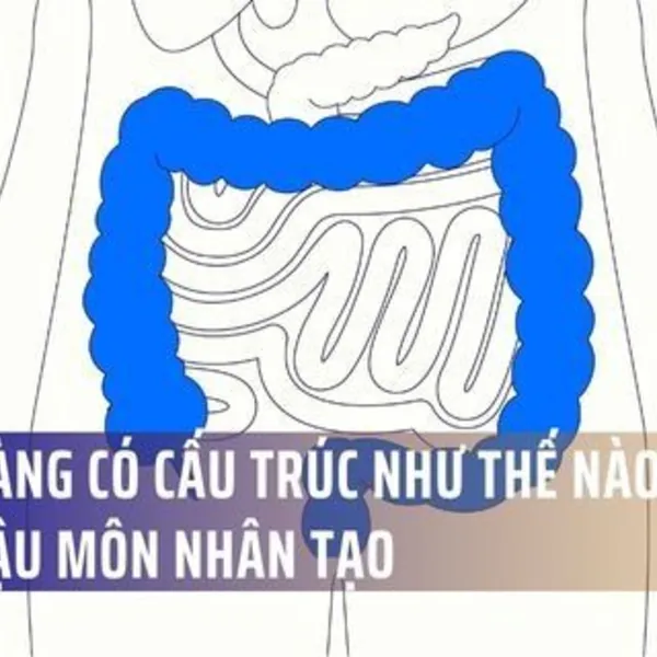 Đại tràng có cấu trúc như thế nào? Các loại hậu môn nhân tạo
