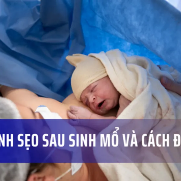 Sẹo mổ sau sinh: Hình ảnh vết mổ sau sinh bị lồi và Cách điều trị