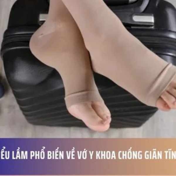 5 Hiểu Lầm Phổ Biến Về Vớ Y Khoa Chống Giãn Tĩnh Mạch