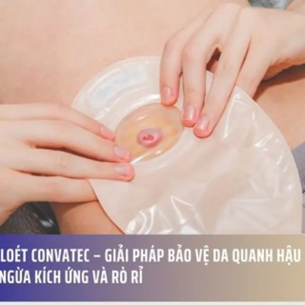 Bột chống loét convatec – Giải pháp bảo vệ da quanh hậu môn nhân tạo, ngăn ngừa kích ứng và rò rỉ