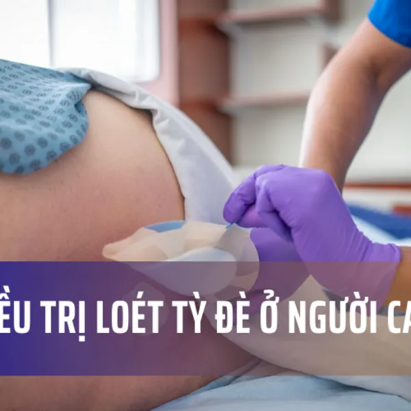 Cách điều trị loét da do tỳ đè ở người cao tuổi