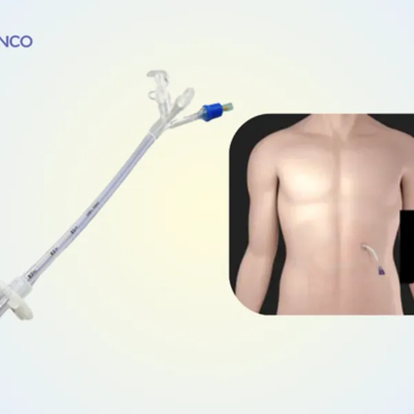 Những điều cần biết về chăm sóc ống mở thông dạ dày qua da PEG và cách xử lý biến chứng