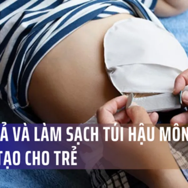 Cách xả và làm sạch túi hậu môn nhân tạo cho trẻ