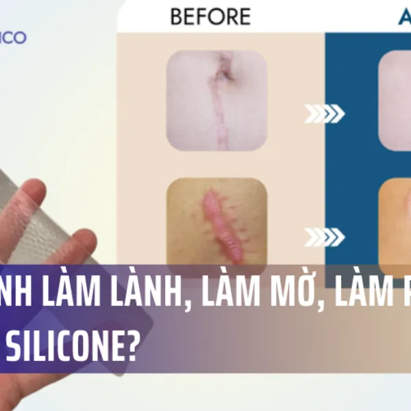 Quy trình làm lành, làm mờ, làm phẳng sẹo của silicone?