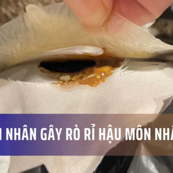 Nguyên nhân gây rò rỉ túi hậu môn nhân tạo