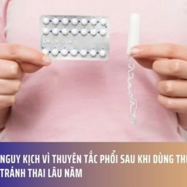 Nguy Kịch Vì Thuyên Tắc Phổi Sau Khi Dùng Thuốc Tránh Thai Lâu Năm