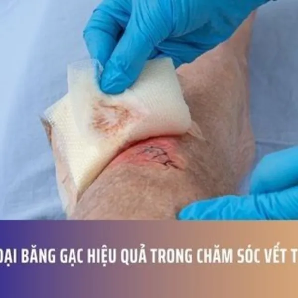 Các Loại Băng Gạc Hiệu Quả Trong Chăm Sóc Vết Thương