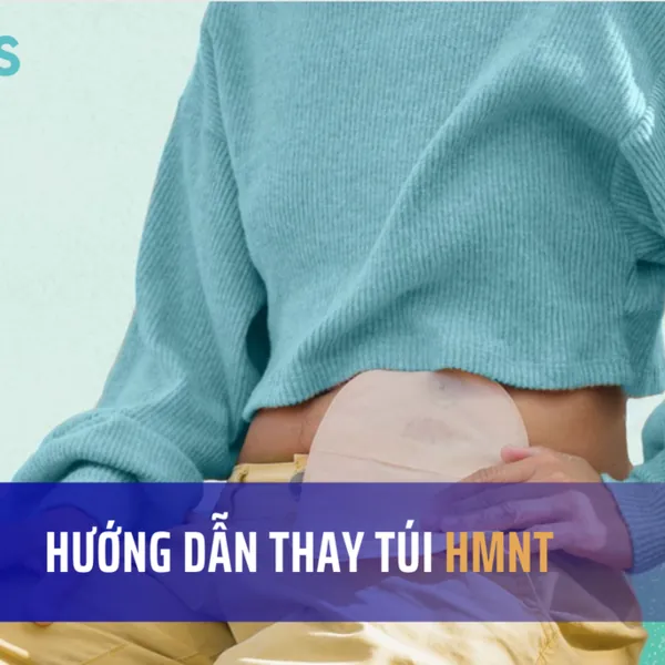 Cách làm sạch túi Hậu môn nhân tạo