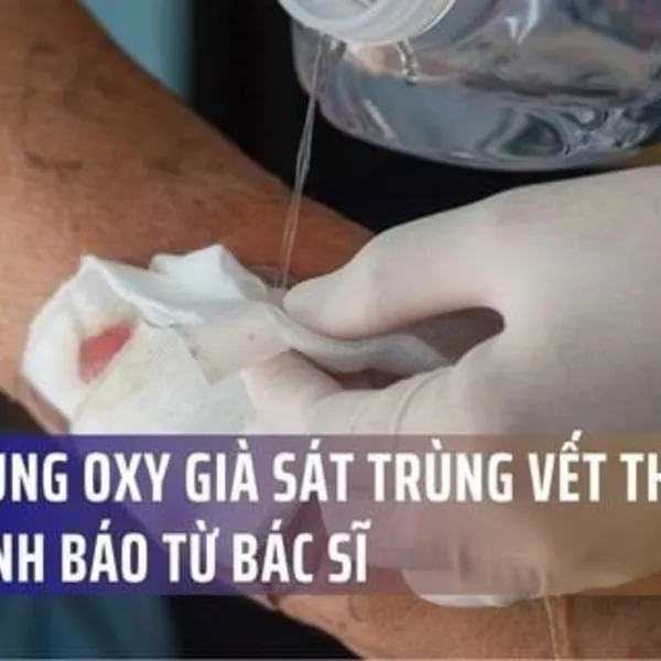 Lạm dụng oxy già sát trùng vết thương hở: Cảnh báo từ bác sĩ