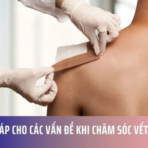 Giải Pháp Cho Các Vấn Đề Khi Chăm Sóc Vết Thương