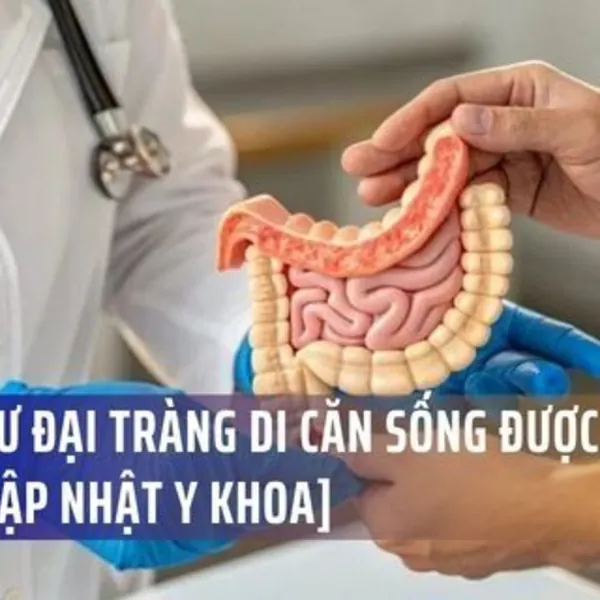 Ung Thư Đại Tràng Di Căn Sống Được Bao Lâu? [Cập Nhật Y Khoa]