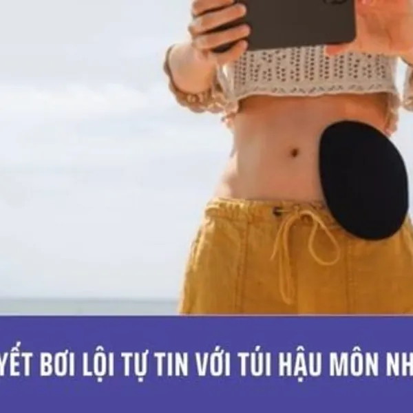 Bí Quyết Bơi Lội Tự Tin Với Túi Hậu Môn Nhân Tạo