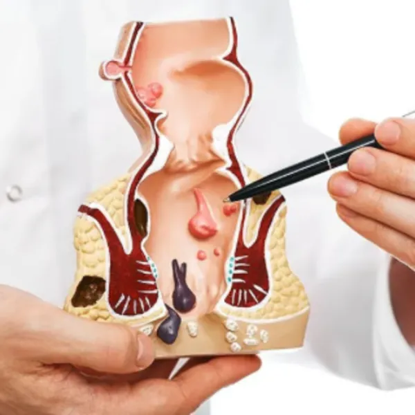 Các phương pháp điều trị rò hậu môn
