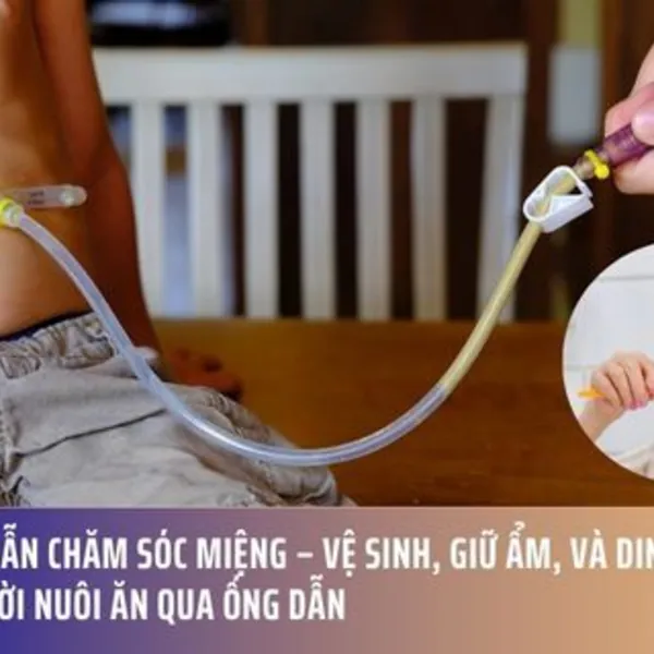 Hướng Dẫn Chăm Sóc Miệng – Vệ Sinh, Giữ Ẩm, Và Dinh Dưỡng Cho Người Nuôi Ăn Qua Ống Dẫn