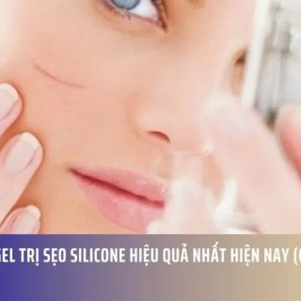 Top 5 Gel Trị Sẹo Silicone Hiệu Quả Nhất Hiện Nay (Cập Nhật 2025)
