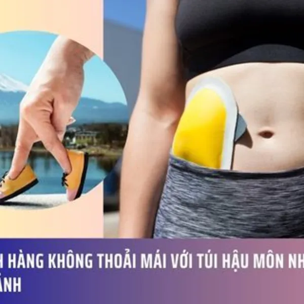 Du lịch hàng không thoải mái với túi hậu môn nhân tạo hai mảnh