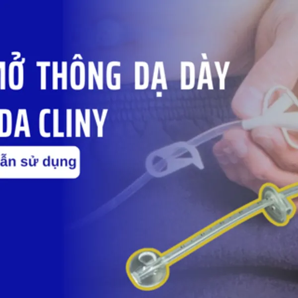 Hướng dẫn sử dụng bộ mở thông dạ dày qua da Cliny
