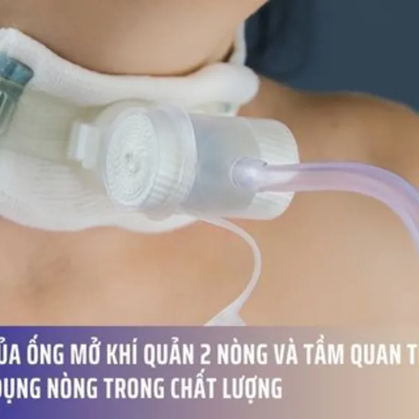 Lợi ích của ống mở khí quản 2 nòng và tầm quan trọng của việc sử dụng nòng trong chất lượng