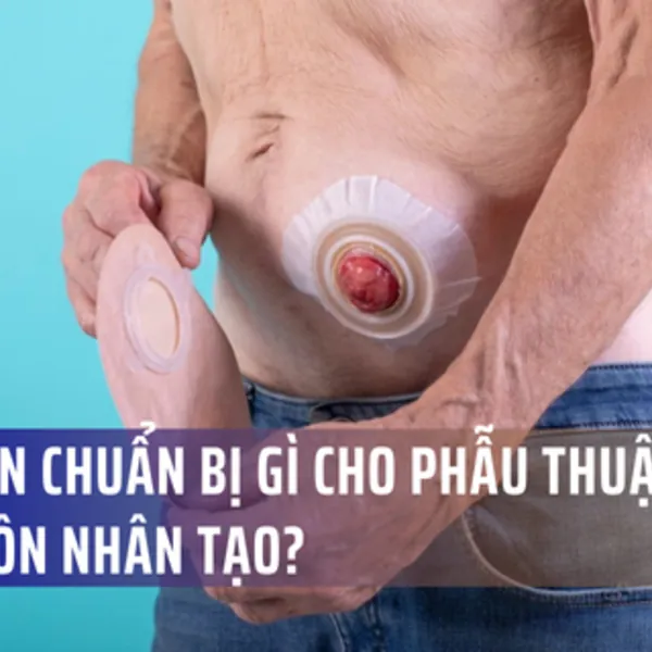 Chuẩn bị cho phẫu thuật hậu môn nhân tạo như thế nào?