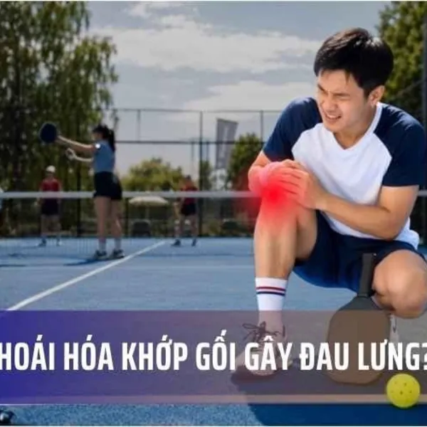 Hội Chứng Gối - Cột Sống: Vì Sao Thoái Hóa Khớp Gối Gây Đau Lưng?