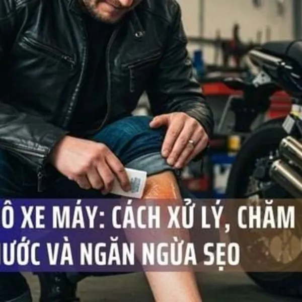 Bỏng bô xe máy: Cách xử lý, chăm sóc bọng nước và ngăn ngừa sẹo