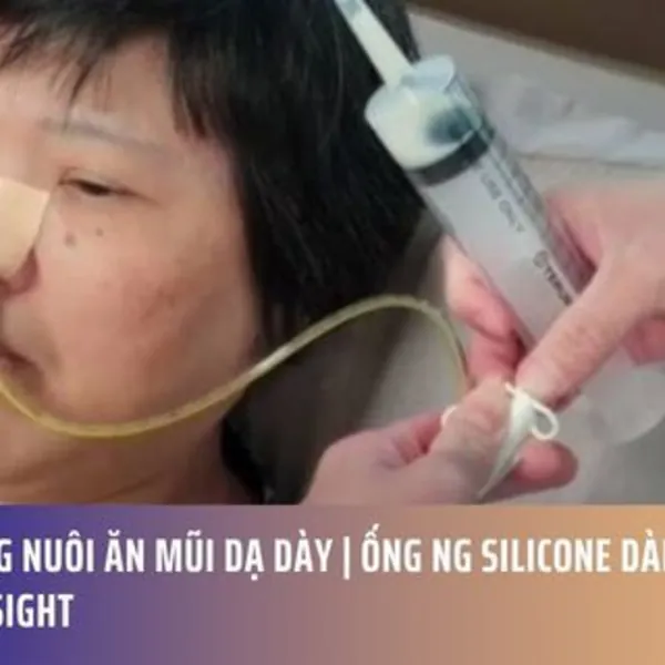 Xông Nuôi Ăn Mũi Dạ Dày | Ống NG Silicone Dài Ngày Seasight