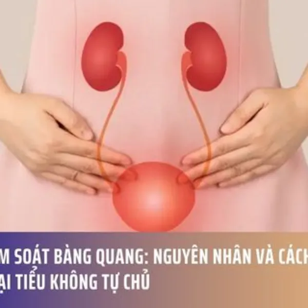 Mất Kiểm Soát Bàng Quang: Nguyên Nhân Và Cách Điều Trị Từng Loại Tiểu Không Tự Chủ