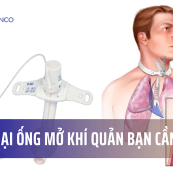 Các loại ống mở khí quản bạn cần biết!