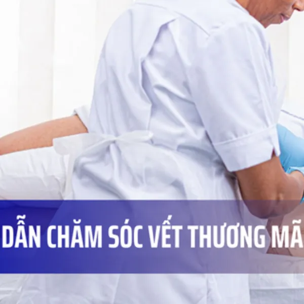 Hướng dẫn chăm sóc vết thương mãn tính