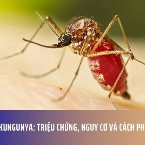 Bệnh Chikungunya: Triệu Chứng, Nguy Cơ Và Cách Phòng Ngừa