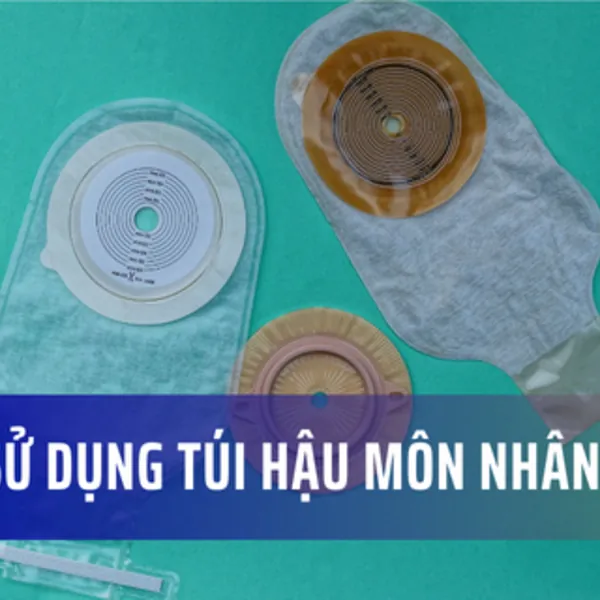 Cách sử dụng túi hậu môn nhân tạo