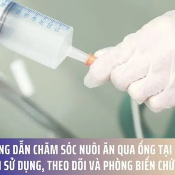 Hướng dẫn chăm sóc nuôi ăn qua ống tại nhà: Cách sử dụng, theo dõi và phòng biến chứng