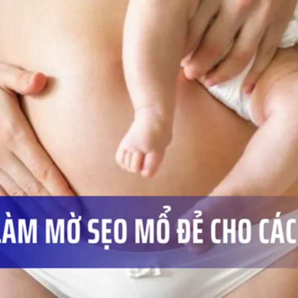 Cách làm mờ sẹo sau sinh mổ, mẹ nên chú ý gì?