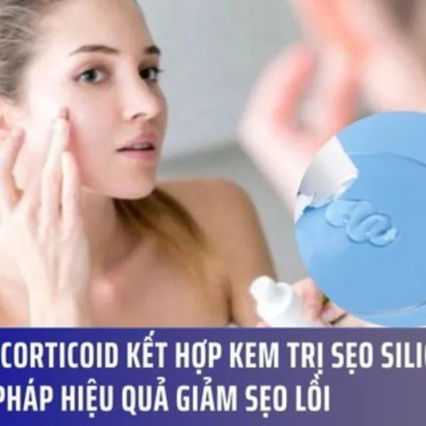 Tiêm Corticoid Kết Hợp Kem trị sẹo Silicone – Giải Pháp Hiệu Quả Giảm Sẹo Lồi