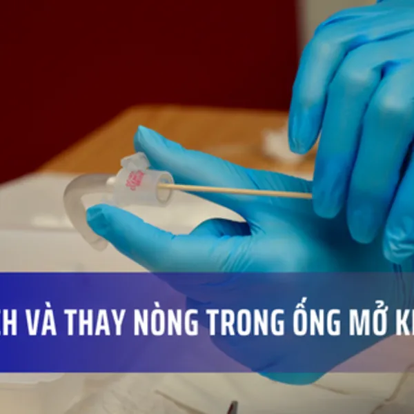 Cách làm sạch và thay nòng trong ống mở khí quản