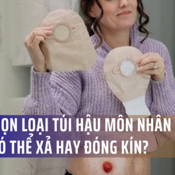 Nên chọn loại túi hậu môn nhân tạo nào: Có thể xả hay đóng kín?