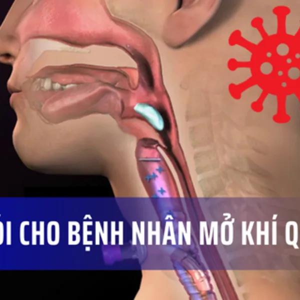 Tập nói cho bệnh nhân Mở khí quản