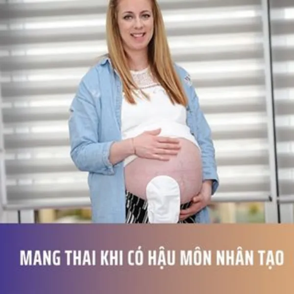 Mang Thai Khi Có Hậu Môn Nhân Tạo