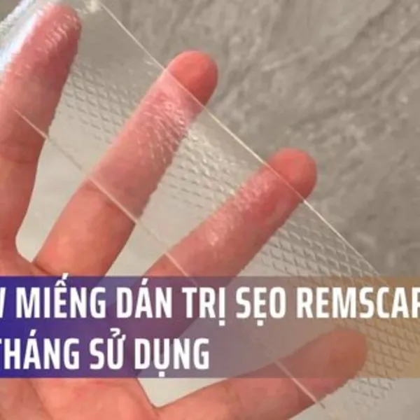 Review miếng dán trị sẹo RemScar TR sau 2 tháng sử dụng