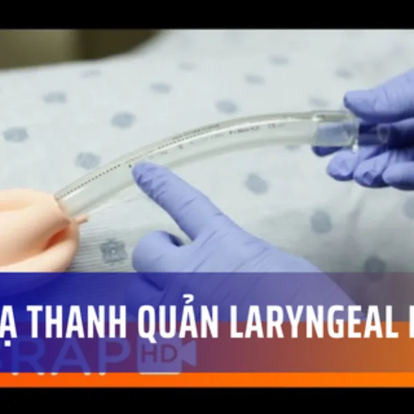 Mặt nạ thanh quản Laryngeal Mask