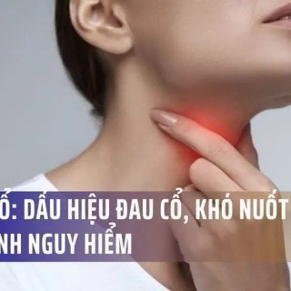 Áp Xe Cổ: Dấu Hiệu Đau Cổ, Khó Nuốt Cảnh Báo Bệnh Nguy Hiểm