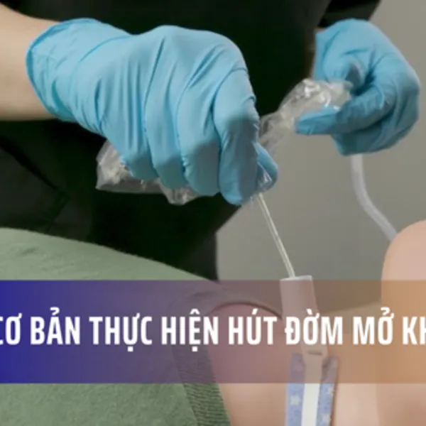 7 bước cơ bản thực hiện hút đờm mở khí quản bằng xông hút