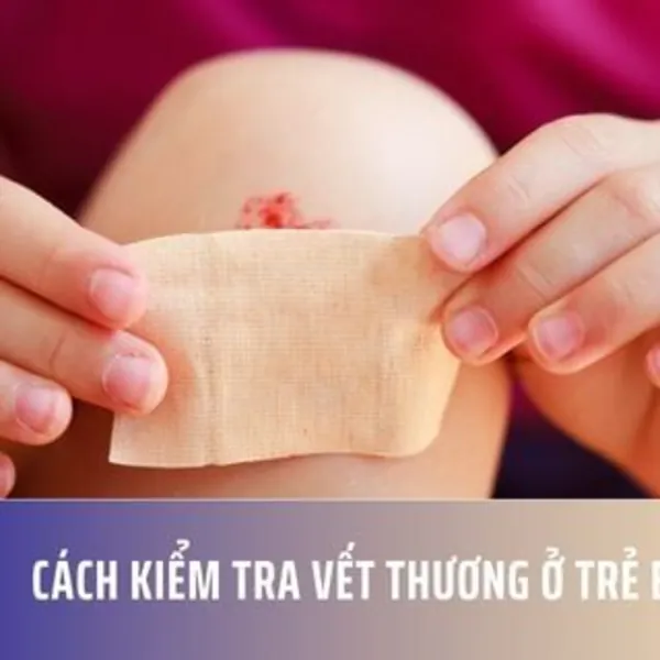 Cách Kiểm Tra Vết Thương Ở Trẻ Em