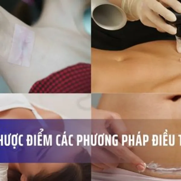 Ưu và nhược điểm các phương pháp điều trị sẹo