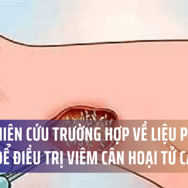 Một trường hợp nghiên cứu về áp dụng liệu pháp áp lực âm để điều trị viêm cân hoại tử cấp tính