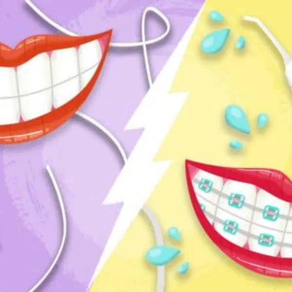 Máy tăm nước vs. Chỉ tơ nha khoa: Loại nào tốt hơn?